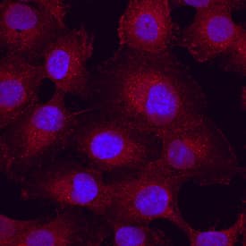 Integrin aV beta 5 was detected in immersion fixed HT1080 human fibrosarcoma cell line using Human Integrin aV beta 5 Monoclonal Antibody (Catalog # MAB2528) at 10 µg/mL for 3 hours at room temperature. Cells were stained using the NorthernLights™ 557-conjugated Anti-Mouse IgG Secondary Antibody (red; NL007) and counterstained with DAPI (blue). View our protocol for Fluorescent ICC Staining of Cells on Coverslips.