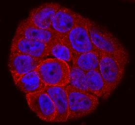 Integrin  beta 6 was detected in immersion fixed HT-29 human colon adenocarcinoma cell line using Sheep Anti-Human Integrin  beta 6 Antigen Affinity-purified Polyclonal Antibody (Catalog # AF4155) at 10 µg/mL for 3 hours at room temperature. Cells were stained using the NorthernLights™ 557-conjugated Anti-Sheep IgG Secondary Antibody (red; Catalog # NL010) and counterstained with DAPI (blue). Specific staining was localized to cytoplasm and cell surface. View our protocol for Fluorescent ICC Staining of Cells on Coverslips.