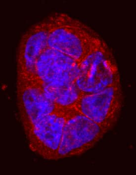 Integrin  beta 6 was detected in immersion fixed HT-29 human colon adenocarcinoma cell line using Sheep Anti-Human Integrin  beta 6 Biotinylated Antigen Affinity-purified Polyclonal Antibody (Catalog # BAF4155) at 10 µg/mL for 3 hours at room temperature. Cells were stained using the NorthernLights™ 557-conjugated Streptavidin (red; Catalog # NL999) and counterstained with DAPI(blue). Specific staining was localized to cytoplasm and cell surface. View our protocol for Fluorescent ICC Staining of Cells on Coverslips.