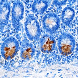 Intelectin-2 was detected in formalin fixed paraffin-embedded sections of human small intestine using Mouse Anti-Human Intelectin-2 Monoclonal Antibody (Catalog # MAB8004) at 5 µg/mL overnight at 4 °C. Tissue was stained using the Anti-Mouse HRP-DAB Cell & Tissue Staining Kit (brown; Catalog # CTS002) and counterstained with hematoxylin (blue). Specific staining was localized to Paneth cells in intestinal glands. View our protocol for Chromogenic IHC Staining of Paraffin-embedded Tissue Sections.