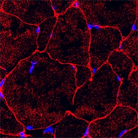 Irisin/FNDC5 was detected in perfusion fixed frozen sections of rat skeletal muscle using Mouse Anti-Human Irisin/FNDC5 Monoclonal Antibody (Catalog # MAB9420) at 25 µg/mL overnight at 4 °C. Tissue was stained using the NorthernLights™ 557-conjugated Anti-Mouse IgG Secondary Antibody (red; NL007) and counterstained with DAPI (blue). Specific staining was localized to plasma membrane and cytoplasm of muscle cells. View our protocol for Fluorescent IHC Staining of Frozen Tissue Sections.