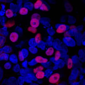 Immunocytochemistry Islet-1 Antibody [Unconjugated]
