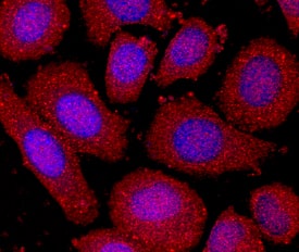 Isocitrate Dehydrogenase 1/IDH1 was detected in immersion fixed SK-BR-3 human breast cancer cell line using Mouse Anti-Human Isocitrate Dehydrogenase 1/IDH1 Monoclonal Antibody (Catalog # MAB7049) at 10 µg/mL for 3 hours at room temperature. Cells were stained using the NorthernLights™ 557-conjugated Anti-Mouse IgG Secondary Antibody (red; NL007) and counterstained with DAPI (blue). Specific staining was localized to cytoplasm. View our protocol for Fluorescent ICC Staining of Cells on Coverslips.