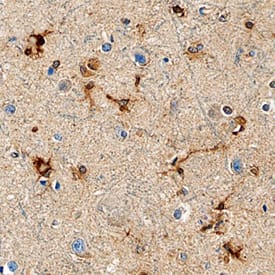 Isocitrate Dehydrogenase 1/IDH1 was detected in immersion fixed paraffin-embedded sections of human brain (cortex) using Mouse Anti-Human Isocitrate Dehydrogenase 1/IDH1 Monoclonal Antibody (Catalog # MAB7049) at 15 µg/mL overnight at 4 °C. Before incubation with the primary antibody, tissue was subjected to heat-induced epitope retrieval using Antigen Retrieval Reagent-Basic (CTS013). Tissue was stained using the Anti-Mouse HRP-DAB Cell & Tissue Staining Kit (brown; CTS002) and counterstained with hematoxylin (blue). Specific staining was localized to astrocytes. View our protocol for Chromogenic IHC Staining of Paraffin-embedded Tissue Sections.