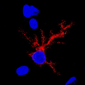 Isocitrate Dehydrogenase 1/IDH1 was detected in perfusion fixed frozen sections of rat brain using Mouse Anti-Human Isocitrate Dehydrogenase 1/IDH1 Monoclonal Antibody (Catalog # MAB7049) at 15 µg/mL overnight at 4 °C. Tissue was stained using the NorthernLights™ 557-conjugated Anti-Mouse IgG Secondary Antibody (red; NL007) and counterstained with DAPI (blue). Specific staining was localized to glial cell cytoplasm. View our protocol for Fluorescent IHC Staining of Frozen Tissue Sections.