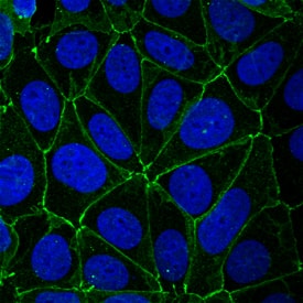 JAM-A was detected in immersion fixed MCF-7 human breast cancer cell line using Goat Anti-Human JAM-A Antigen Affinity-purified Polyclonal Antibody (Catalog # AF1103) at 10 µg/mL for 3 hours at room temperature. Cells were stained using the NorthernLights™ 493-conjugated Anti-Goat IgG Secondary Antibody (green; Catalog # NL003) and counterstained with DAPI (blue). Specific staining was localized to intercellular junctions. View our protocol for Fluorescent ICC Staining of Cells on Coverslips.