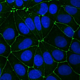 JAM-A was detected in immersion fixed MCF-7 human breast cancer cell line using Mouse Anti-Human JAM-A Monoclonal Antibody (Catalog # MAB1103) at 20 µg/mL for 3 hours at room temperature. Cells were stained using the NorthernLights™ 493-conjugated Anti-Mouse IgG Secondary Antibody (green; Catalog # NL009) and counterstained with DAPI (blue). Specific staining was localized to intercellular junctions. View our protocol for Fluorescent ICC Staining of Cells on Coverslips.