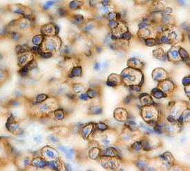 JAM-C was detected in immersion fixed frozen sections of mouse embryo (15 d.p.c.) using Goat Anti-Mouse JAM-C Antigen Affinity-purified Polyclonal Antibody (Catalog # AF1213) at 15 µg/mL overnight at 4 °C. Tissue was stained using the Anti-Goat HRP-DAB Cell & Tissue Staining Kit (brown; Catalog # CTS008) and counterstained with hematoxylin (blue). Specific staining was localized to muscle cells. View our protocol for Chromogenic IHC Staining of Frozen Tissue Sections.