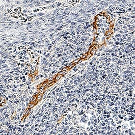 Immunohistochemistry JAM-B/VE-JAM Antibody [Unconjugated]