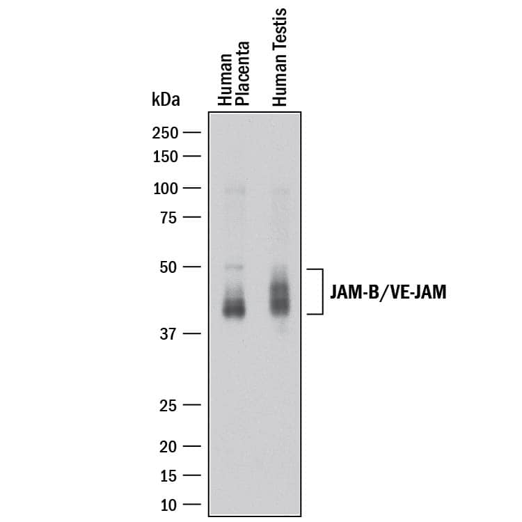 Western Blot JAM-B/VE-JAM Antibody [Unconjugated]
