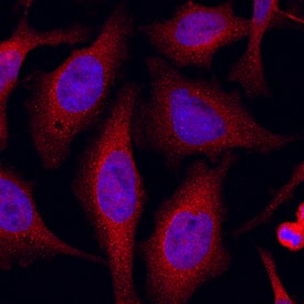 JNK1/JNK2 was detected in immersion fixed HeLa human cervical epithelial carcinoma cell line using Mouse Anti-Human/Mouse/Rat JNK1/JNK2 Monoclonal Antibody (Catalog # MAB2076) at 10 µg/mL for 3 hours at room temperature. Cells were stained using the NorthernLights™ 557-conjugated Anti-Mouse IgG Secondary Antibody (red; Catalog # NL007) and counterstained with DAPI (blue). Specific staining was localized to cytoplasm. View our protocol for Fluorescent ICC Staining of Cells on Coverslips.