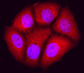 Immunocytochemistry JNK1 Antibody (228601) [Unconjugated]
