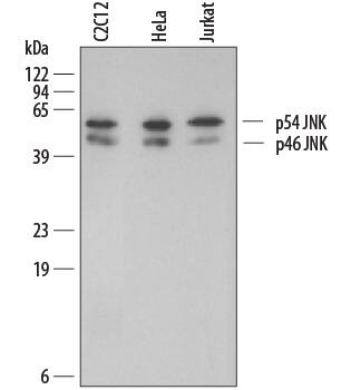 Western blot shows lysates of C2C12 mouse myoblast cell line, HeLa human cervical epithelial carcinoma cell line, and Jurkat human acute T cell leukemia cell line. PVDF membrane was probed with 0.2 µg/mL Rabbit Anti-Human/Mouse/Rat JNK2 Antigen Affinity-purified Polyclonal Antibody (Catalog # AF1846) followed by HRP-conjugated Anti-Rabbit IgG Secondary Antibody (Catalog # HAF008). specific bands for JNK2 was detected at approximately 46 and 54 kDa (as indicated). This experiment was conducted under reducing conditions and using Immunoblot Buffer Group 1.