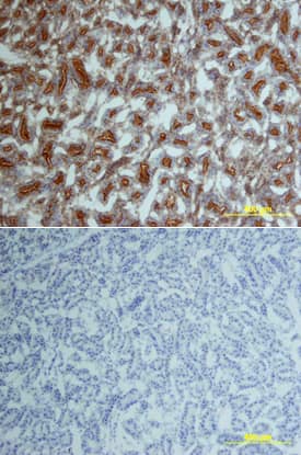 JNK was detected in perfusion fixed frozen sections of rat kidney using Rabbit Anti-Human/Mouse/Rat JNK Antigen Affinity-purified Polyclonal Antibody (Catalog # AF1387) at 15 µg/mL overnight at 4 °C. Tissue was stained using the Anti-Rabbit HRP-DAB Cell & Tissue Staining Kit (brown; Catalog # CTS005) and counterstained with hematoxylin (blue). Lower panel shows a lack of labeling if primary antibodies are omitted and tissue is stained only with secondary antibody followed by incubation with detection reagents. View our protocol for Chromogenic IHC Staining of Frozen Tissue Sections.