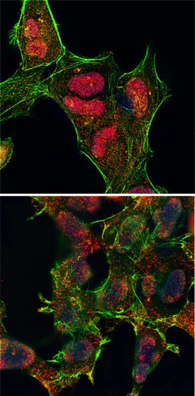 <b>Biological Strategies Validation. </b>JNK phosphorylated at T183/Y185 was detected in immersion fixed HEK293 human embryonic kidney cell line untreated (lower panel) or treated with UV radiation (upper panel) using Rabbit Anti-Human/Mouse/Rat Phospho-JNK (T183/Y185) Monoclonal Antibody (Catalog # MAB1205) at 25 µg/ml for 3 hours at room temperature. Cells were stained using the NorthernLights™ 557-conjugated Anti-Rabbit IgG Secondary Antibody (red; Catalog # NL004) and counterstained with DAPI. Filamentous actin was stained with fluorescein-conjugated phalloidin (green). Specific staining was localized to nuclei. View our protocol for Fluorescent ICC Staining of Cells on Coverslips.