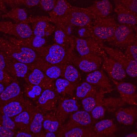 Jade-1/PHF17 was detected in immersion fixed HeLa human cervical epithelial carcinoma cell line using Mouse Anti-Human Jade-1/PHF17 Monoclonal Antibody (Catalog # MAB6275) at 10 µg/mL for 3 hours at room temperature. Cells were stained using the NorthernLights™ 557-conjugated Anti-Mouse IgG Secondary Antibody (red; Catalog # NL007) and counterstained with DAPI (blue). Specific staining was localized to nuclei and cytoplasm. View our protocol for Fluorescent ICC Staining of Cells on Coverslips.