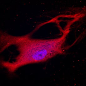 Jagged 2 was detected in immersion fixed HUVEC human umbilical vein endothelial cells using Goat Anti-Human Jagged 2 Antigen Affinity-purified Polyclonal Antibody (Catalog # AF1726) at 10 µg/mL for 3 hours at room temperature. Cells were stained using the NorthernLights™ 557-conjugated Anti-Goat IgG Secondary Antibody (red; Catalog # NL001) and counterstained with DAPI (blue). View our protocol for Fluorescent ICC Staining of Cells on Coverslips.