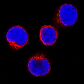 Immunocytochemistry Jak3 Antibody (452524) [Unconjugated]