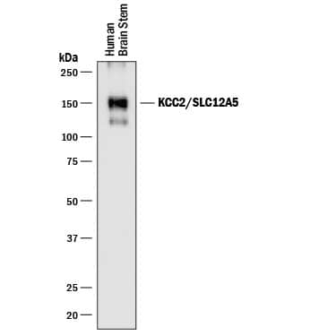 Western blot shows lysates of human brain stem tissue. PVDF membrane was probed with 0.5 µg/mL of Mouse Anti-Human KCC2/SLC12A5 Monoclonal Antibody (Catalog # MAB8369) followed by HRP-conjugated Anti-Mouse IgG Secondary Antibody (Catalog # HAF018). A specific band was detected for KCC2/SLC12A5 at approximately 150 kDa (as indicated). This experiment was conducted under reducing conditions and using Immunoblot Buffer Group 1.