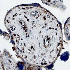 KGF/FGF-7 was detected in immersion fixed paraffin-embedded sections of canine placenta (chorionic villi) using Mouse Anti-Canine KGF/FGF-7 Monoclonal Antibody (Catalog # MAB1957) at 25 µg/mL overnight at 4 °C. Tissue was stained using the Anti-Mouse HRP-DAB Cell & Tissue Staining Kit (brown; Catalog # CTS002) and counterstained with hematoxylin (blue). Specific staining was localized to chorionic villi trophoblasts. View our protocol for Chromogenic IHC Staining of Paraffin-embedded Tissue Sections.
