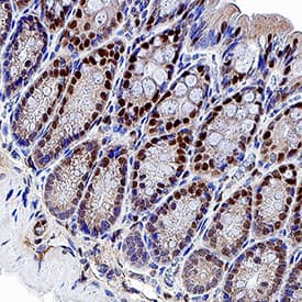 KLF4 was detected in perfusion fixed frozen sections of mouse colon tissue using Goat Anti-Mouse KLF4 Antigen Affinity-purified Polyclonal Antibody (Catalog # AF3158) at 1 µg/mL overnight at 4 °C. Before incubation with the primary antibody, tissue was subjected to heat-induced epitope retrieval using Antigen Retrieval Reagent-Basic (CTS013). Tissue was stained using the Anti-Goat IgG VisUCyte™ HRP Polymer Antibody (brown; VC004) and counterstained with hematoxylin (blue). Specific staining was localized to cell nuclei. View our protocol for IHC Staining with VisUCyte HRP Polymer Detection Reagents.