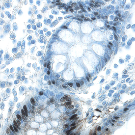 KLF4 was detected in immersion fixed paraffin-embedded sections of human colon using 15 µg/mL Goat Anti-Human KLF4 Antigen Affinity-purified Polyclonal Antibody (Catalog # AF3640) overnight at 4 °C. Tissue was stained with the Anti-Goat HRP-DAB Cell & Tissue Staining Kit (brown; Catalog # CTS008) and counterstained with hematoxylin (blue). Specific labeling was localized to the nuclei of epithelial cells. View our protocol for Chromogenic IHC Staining of Paraffin-embedded Tissue Sections.