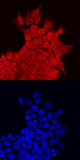 Immunocytochemistry KLF5 Antibody [Unconjugated]