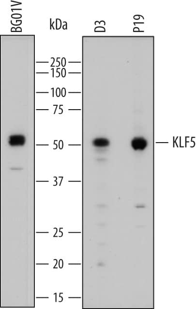 Western Blot KLF5 Antibody [Unconjugated]