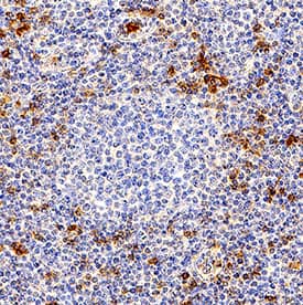 KLRG1 was detected in immersion fixed paraffin-embedded sections of human tonsil using Rabbit Anti-Human KLRG1 Monoclonal Antibody (Catalog # MAB70293) at 3 µg/mL for 1 hour at room temperature followed by incubation with the Anti-Rabbit IgG VisUCyte™ HRP Polymer Antibody (Catalog # VC003). Before incubation with the primary antibody, tissue was subjected to heat-induced epitope retrieval using Antigen Retrieval Reagent-Basic (Catalog # CTS013). Tissue was stained using DAB (brown) and counterstained with hematoxylin (blue). Specific staining was localized to cytoplasm in lymphocytes. View our protocol for IHC Staining with VisUCyte HRP Polymer Detection Reagents.
