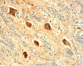 KOR was detected in immersion fixed paraffin-embedded sections of human brainstem (medulla) using 15 µg/mL Mouse Anti-Human KOR Monoclonal Antibody (Catalog # MAB38951) overnight at 4 °C. Before incubation with the primary antibody tissue was subjected to heat-induced epitope retrieval using Antigen Retrieval Reagent-Basic (Catalog # CTS013). Tissue was stained with the Anti-Mouse HRP-DAB Cell & Tissue Staining Kit (brown; Catalog # CTS002) and counterstained with hematoxylin (blue). View our protocol for Chromogenic IHC Staining of Paraffin-embedded Tissue Sections.