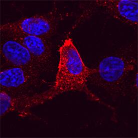 KOR was detected in immersion fixed CHO Chinese hamster ovary cell line transfected with KOR using Rabbit Anti-Rat KOR Monoclonal Antibody (Catalog # MAB8867) at 10 &micro;g/mL for 3 hours at room temperature. Cells were stained using the NorthernLights&trade; 557-conjugated Anti-Rabbit IgG Secondary Antibody (red; Catalog # NL004) and counterstained with DAPI (blue). Specific staining was localized to plasma membrane and cytoplasm. View our protocol for Fluorescent ICC Staining of Cells on Coverslips.