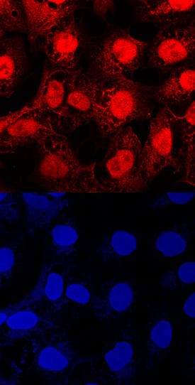 Importin a2/KPNA2 was detected in immersion fixed NTera-2 human testicular embryonic carcinoma cell line using Sheep Anti-Human Importin a2/KPNA2 Antigen Affinity-purified Polyclonal Antibody (Catalog # AF6207) at 10 µg/mL for 3 hours at room temperature. Cells were stained using the NorthernLights™ 557-conjugated Anti-Sheep IgG Secondary Antibody (red, upper panel; Catalog # NL010) and counterstained with DAPI (blue, lower panel). Specific staining was localized to cytoplasm and nuclei. View our protocol for Fluorescent ICC Staining of Cells on Coverslips.