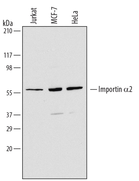 Western blot shows lysates of Jurkat human acute T cell leukemia cell line, MCF-7 human breast cancer cell line, and HeLa human cervical epithelial carcinoma cell line. PVDF Membrane was probed with 0.5 µg/mL of Sheep Anti-Human Importin a2/KPNA2 Antigen Affinity-purified Polyclonal Antibody (Catalog # AF6207) followed by HRP-conjugated Anti-Sheep IgG Secondary Antibody (Catalog # HAF016). A specific band was detected for Importin a2/KPNA2 at approximately 60 kDa (as indicated). This experiment was conducted under reducing conditions and using Immunoblot Buffer Group 1.
