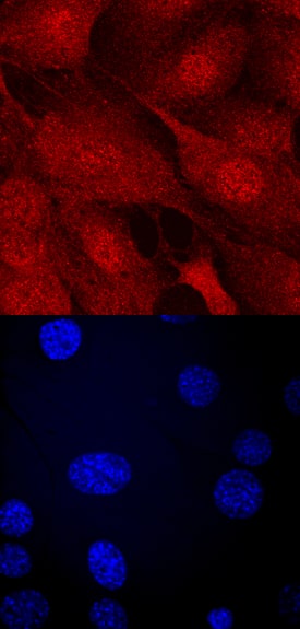 Importin a2/KPNA2 was detected in immersion fixed NTera-2 human testicular embryonic carcinoma cell line using Mouse Anti-Human Importin a2/KPNA2 Monoclonal Antibody (Catalog # MAB62071) at 10 µg/mL for 3 hours at room temperature. Cells were stained using the NorthernLights™ 557-conjugated Anti-Mouse IgG Secondary Antibody (red, upper panel; Catalog # NL007) and counterstained with DAPI (blue, lower panel). Specific staining was localized to nuclei and cytoplasm. View our protocol for Fluorescent ICC Staining of Cells on Coverslips.