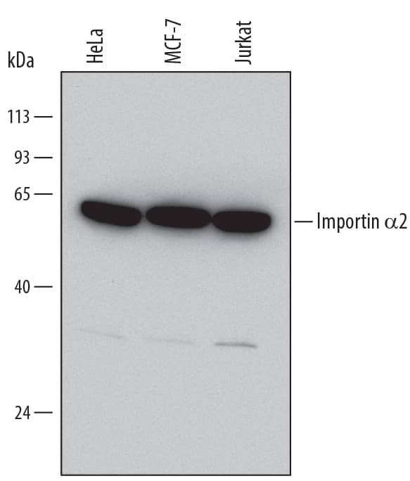 Western blot shows lysates of HeLa human cervical epithelial carcinoma cell line, MCF-7 human breast cancer cell line, and Jurkat human acute T cell leukemia cell line. PVDF Membrane was probed with 0.1 µg/mL of Mouse Anti-Human Importin a2/KPNA2 Monoclonal Antibody (Catalog # MAB6207) followed by HRP-conjugated Anti-Mouse IgG Secondary Antibody (Catalog # HAF007). A specific band was detected for Importin a2/KPNA2 at approximately 60 kDa (as indicated). This experiment was conducted under reducing conditions and using Immunoblot Buffer Group 1.