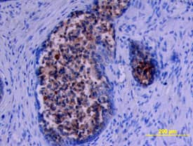 Immunohistochemistry Kallikrein 11 Antibody [Unconjugated]