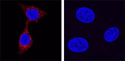 Immunocytochemistry Kallikrein 3/PSA Antibody [Unconjugated]