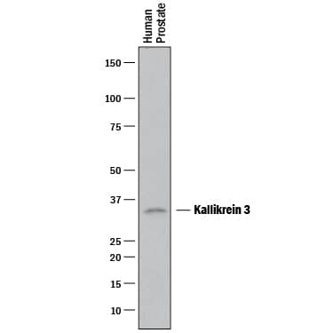 Western Blot Kallikrein 3/PSA Antibody [Unconjugated]