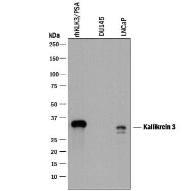 Western Blot Kallikrein 3/PSA Antibody [Unconjugated]