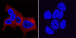 Kallikrein 3/PSA was detected in immersion fixed LNCaP human prostate cancer cell line (positive control, left panel) and MCF-7 human breast cancer cell line (negative control, right panel) using Mouse Anti-Human Kallikrein 3/PSA Monoclonal Antibody (Catalog # MAB13441) at 8 µg/mL for 3 hours at room temperature. Cells were stained using the NorthernLights™ 557-conjugated Anti-Mouse IgG Secondary Antibody (red; Catalog # NL007) and counterstained with DAPI (blue). Specific staining was localized to cytoplasm in LNCaP cells. View our protocol for Fluorescent ICC Staining of Cells on Coverslips.