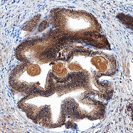 Kallikrein 3/PSA was detected in immersion fixed paraffin-embedded sections of human prostate using Mouse Anti-Human Kallikrein 3/PSA Monoclonal Antibody (Catalog # MAB13441) at 5 µg/mL for 1 hour at room temperature followed by incubation with the Anti-Mouse IgG VisUCyte™ HRP Polymer Antibody (Catalog # VC001). Tissue was stained using DAB (brown) and counterstained with hematoxylin (blue). Specific staining was localized to cytoplasm in epithelial cells. View our protocol for IHC Staining with VisUCyte HRP Polymer Detection Reagents.