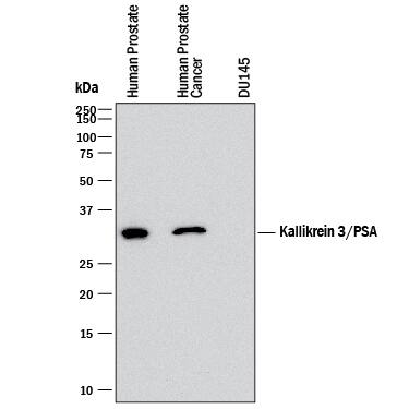 Western blot shows lysates of human prostate tissue, human prostate cancer tissue, and DU145 human prostate carcinoma cell line (negative control). PVDF membrane was probed with 2 µg/mL of Mouse Anti-Human Kallikrein 3/PSA Monoclonal Antibody (Catalog # MAB13443) followed by HRP-conjugated Anti-Mouse IgG Secondary Antibody (Catalog # HAF018). A specific band was detected for Kallikrein 3/PSA at approximately 29 kDa (as indicated). This experiment was conducted under reducing conditions and using Immunoblot Buffer Group 1.