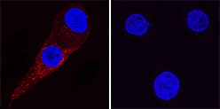 Immunocytochemistry Kallikrein 3/PSA Antibody (181823) [Unconjugated]