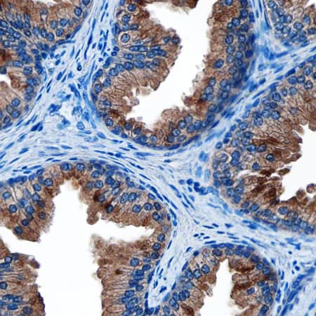 Immunohistochemistry Kallikrein 3/PSA Antibody (181823) [Unconjugated]