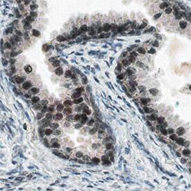 Kallikrein 4/Prostase/EMSP1 was detected in immersion fixed paraffin-embedded sections of human prostate using Mouse Anti-Human Kallikrein 4/Prostase/EMSP1 Monoclonal Antibody (Catalog # MAB35661) at 15 µg/mL overnight at 4 °C. Before incubation with the primary antibody, tissue was subjected to heat-induced epitope retrieval using Antigen Retrieval Reagent-Basic (Catalog # CTS013). Tissue was stained using the Anti-Mouse HRP-DAB Cell & Tissue Staining Kit (brown; Catalog # CTS002) and counter-stained with hematoxylin (blue). Specific staining was localized to nuclei of epithelial cells. View our protocol for Chromogenic IHC Staining of Paraffin-embedded Tissue Sections.