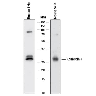 Western Blot Kallikrein 7 Antibody [Unconjugated]