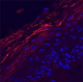 Kallikrein 7 was detected in perfusion fixed frozen sections of mouse skin using Sheep Anti-Mouse Kallikrein 7 Antigen Affinity-purified Polyclonal Antibody (Catalog # AF7688) at 5 µg/mL overnight at 4 °C. Tissue was stained using the NorthernLights™ 557-conjugated Anti-Sheep IgG Secondary Antibody (red; Catalog # NL010) and counterstained with DAPI (blue). Specific staining was localized to keratinocytes. View our protocol for Fluorescent IHC Staining of Frozen Tissue Sections.