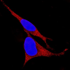 Kallikrein 8/Neuropsin was detected in immersion fixed SH-SY5Y human neuroblastoma cell line using Mouse Anti-Human Kallikrein 8/Neuropsin Monoclonal Antibody (Catalog # MAB1719) at 1 µg/mL for 3 hours at room temperature. Cells were stained using the NorthernLights™ 557-conjugated Anti-Mouse IgG Secondary Antibody (red; Catalog # NL007) and counterstained with DAPI (blue). Specific staining was localized to cytoplasm. View our protocol for Fluorescent ICC Staining of Cells on Coverslips.