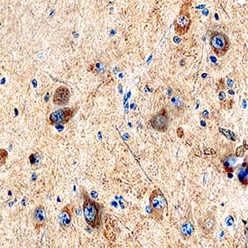 Kallikrein 8/Neuropsin was detected in immersion fixed paraffin-embedded sections of human brain (hippocampus) using Mouse Anti-Human Kallikrein 8/Neuropsin Monoclonal Antibody (Catalog # MAB1719) at 5 µg/mL overnight at 4 °C. Tissue was stained using the Anti-Mouse HRP-DAB Cell & Tissue Staining Kit (brown; Catalog # CTS002) and counterstained with hematoxylin (blue). Specific staining was localized to neuronal cytoplasm. View our protocol for Chromogenic IHC Staining of Paraffin-embedded Tissue Sections.