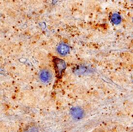 Katanin p60 was detected in immersion fixed paraffin-embedded sections of human brain (globus pallidus) using Mouse Anti-Human Katanin p60 Monoclonal Antibody (Catalog # MAB7100) at 15 µg/mL overnight at 4 °C. Before incubation with the primary antibody, tissue was subjected to heat-induced epitope retrieval using Antigen Retrieval Reagent-Basic (Catalog # CTS013). Tissue was stained using the Anti-Mouse HRP-DAB Cell & Tissue Staining Kit (brown; Catalog # CTS002) and counterstained with hematoxylin (blue). Specific staining was localized to synaptic puncta. View our protocol for Chromogenic IHC Staining of Paraffin-embedded Tissue Sections.